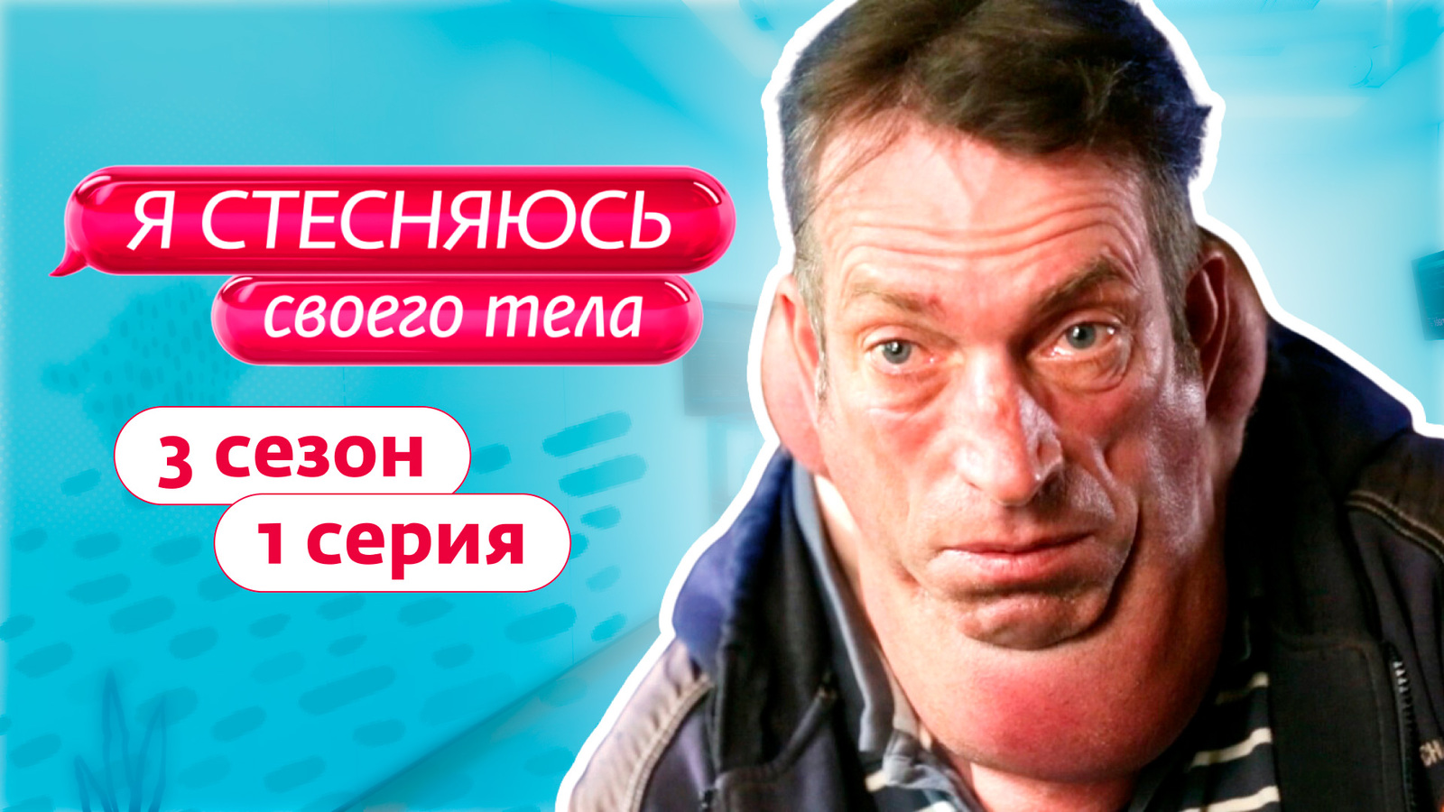 Бакирханов С. К. в проекте "Я стесняюсь своего тела"